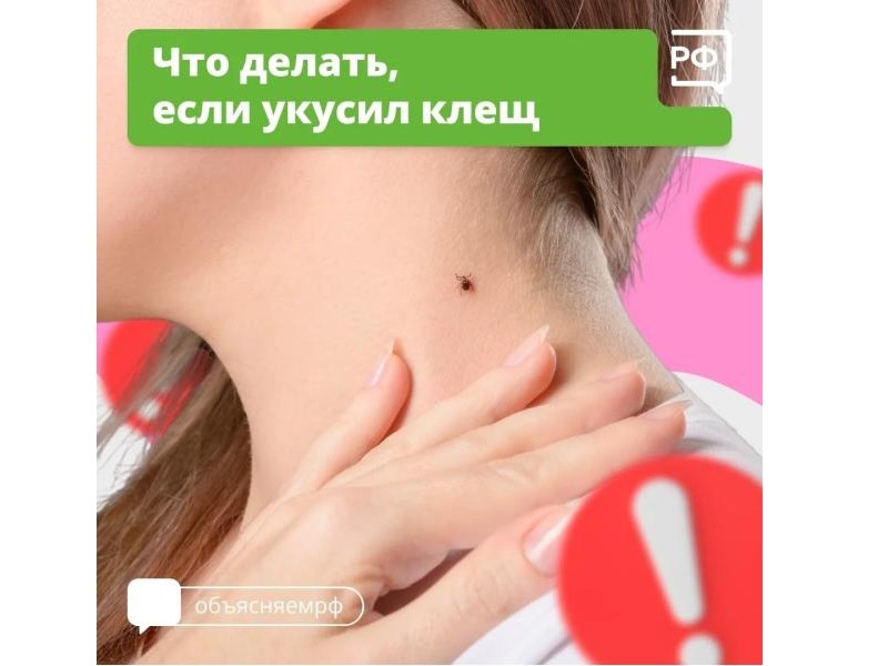 Что делать, если укусил клещ Что делать, если укусил клещ.